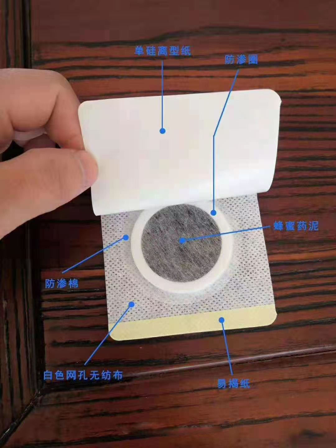 穴位壓力刺激貼。